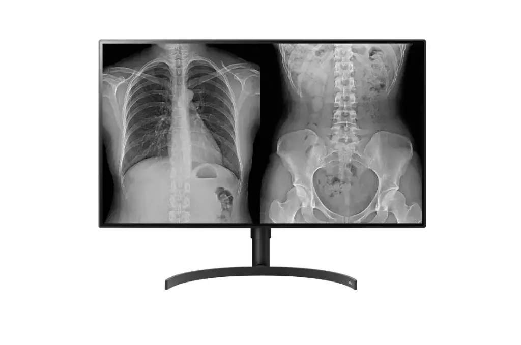 32HL512D-LG 8MP Diagnostic Monitor