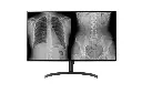 32HL512D-LG 8MP Diagnostic Monitor