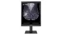 21HQ613D-LG 21.3-inch 5MP IPS Diagnostic Monitor for Mammography