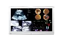 32HL714S-Màn hình phẫu thuật LG 31,5" 4K IPS