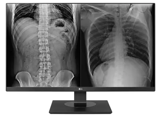 [27HJ713C-B] 27HJ712C
-Màn hình y tế LG 8MP