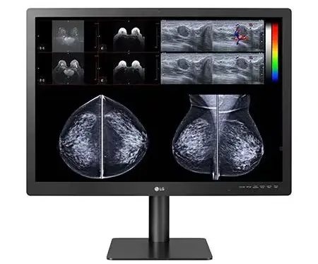 [31HN713D] 31HN713D-Màn hình chẩn đoán LG 31'' 12MP IPS dành cho chụp nhũ ảnh