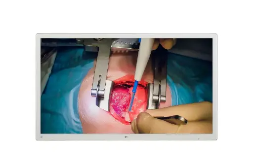 [19HK312C-B] 55MH5K-LG 55'' 4K IPS Surgical Monitor